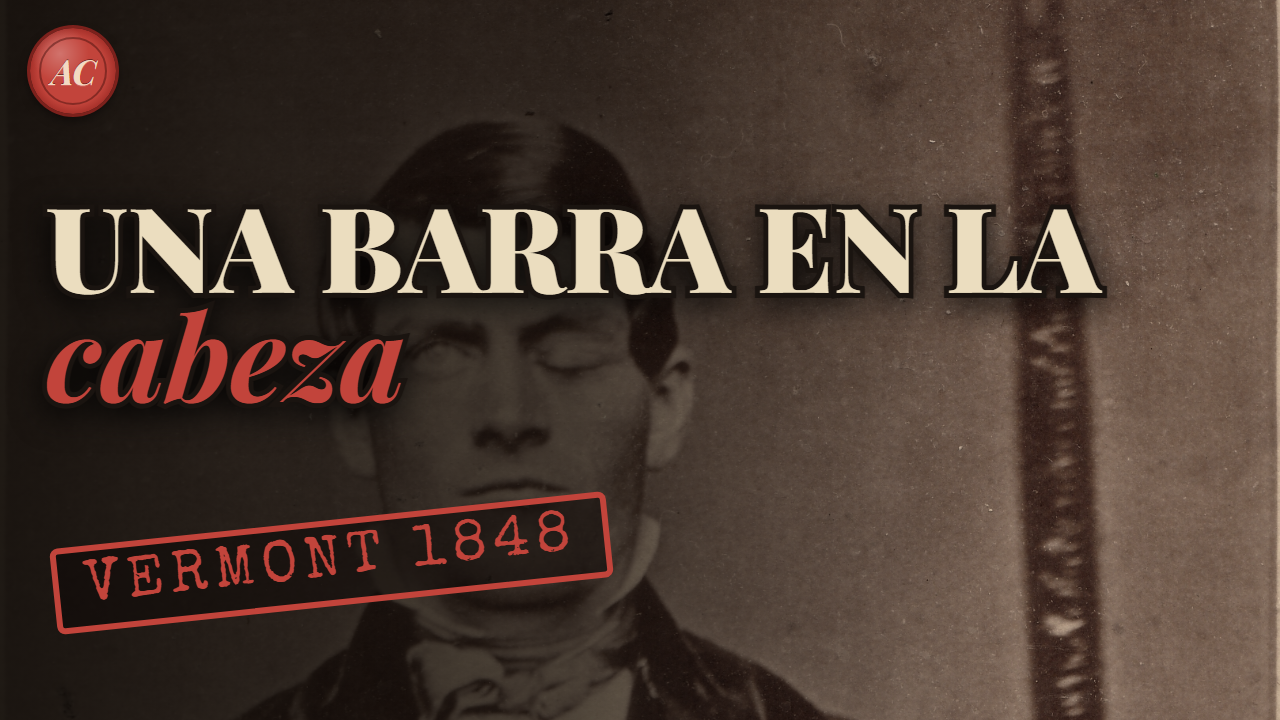 PHINEAS GAGE: el hombre que sobrevivió a una barra de hierro en la cabeza